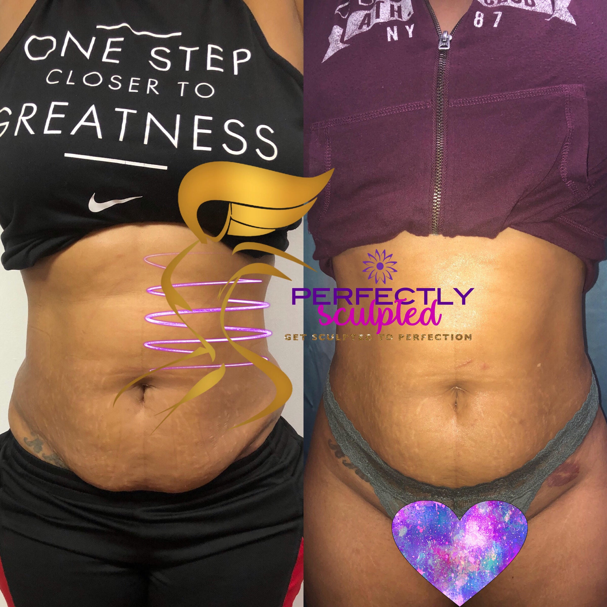 Perfectly sculpted WPB Body Sculpting, Waxing, And Facials